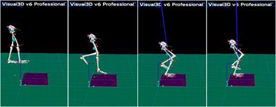 Effects of visual deprivation on the injury of lower extremities among functional ankle instability patients during drop landing: A kinetics perspective